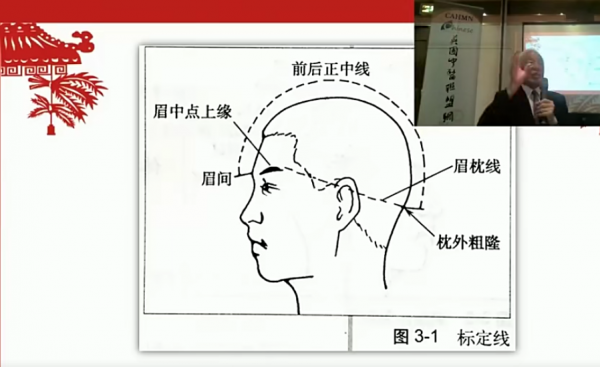 焦氏头针疗法焦顺发头针培训班高清视频教程插图4