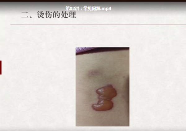 阅素灵中医艾灸视频教程扶阳祛湿补泄手法治疗常见病25讲插图3