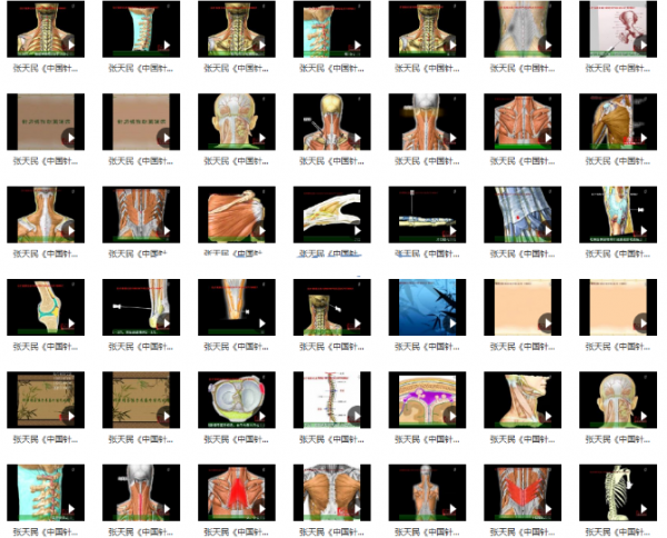 小针刀视频教程张天民中国针刀医学3D动画演示50集完整版插图7