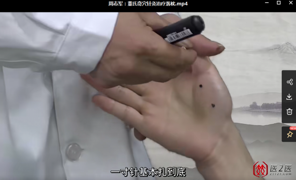 董氏奇穴针灸内部资料最全高清视频教程插图14